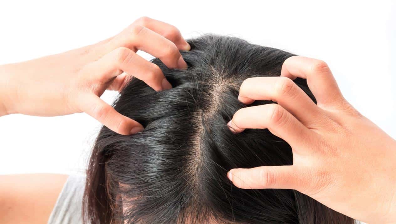 10 أسباب خطيرة وراء حكة فروة الرأس
