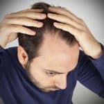 أطعمة تحارب الصلع