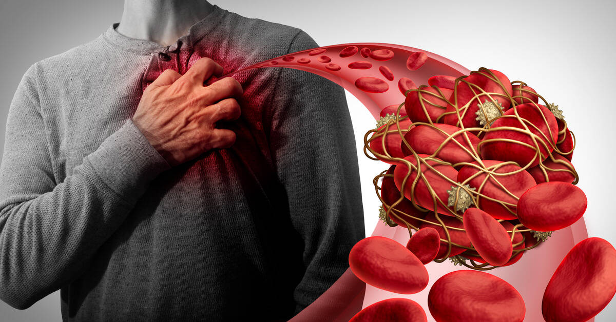 أسباب انسداد شرايين القلب