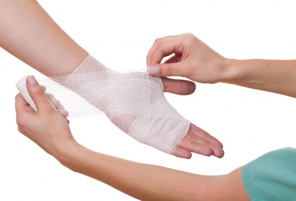 علاج الحروق بشكل خاطئ بـ 6 طرق منزلية