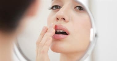 طرق علاج حبوب الشفاه