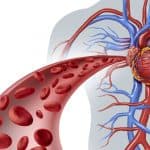 علامات ارتفاع الكوليسترول الضار بالدم وأسبابه