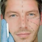 فيديو | استشاري جراحات التجميل يكشف  40% من الرجال بالمملكة لديهم رغبة بإجراء عمليات تجميل