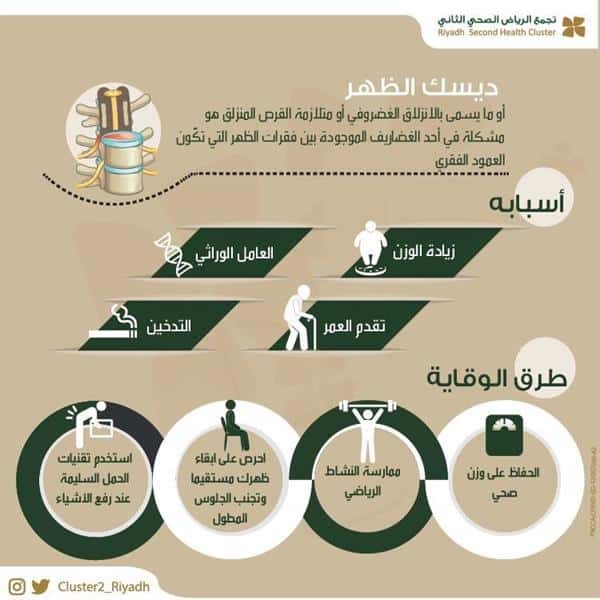 «الصحة» تكشف المقصود بـ ديسك الظهر وطرق الوقاية منه