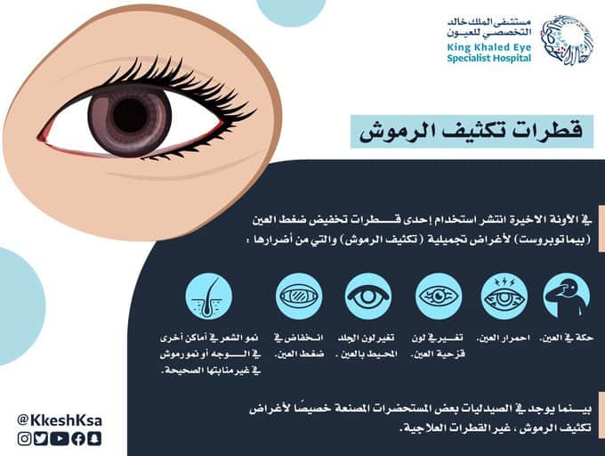 «مستشفى الملك خالد» يحذر من قطرة تكثيف الرموش
