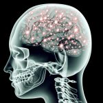 ما هي متلازمة رامزي هانت Ramsay Hunt