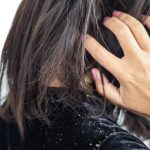 خلطات طبيعية لقشرة الشعر .. تخلصي منها بسهولة