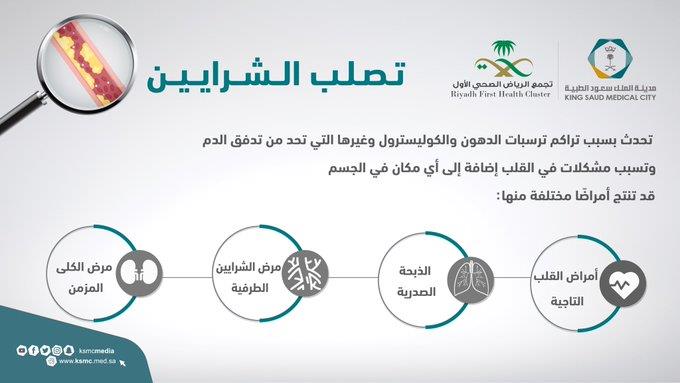 أسباب تصلب الشرايين والأمراض الناتجة عنها.. «سعود الطبية» توضح