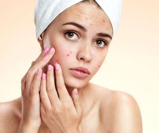 طرق علاج حب الشباب لبشرة صافية ونضرة طوال الوقت