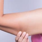 أسباب تراكم الدهون في الذراعين ؟ «مختص» يجيب