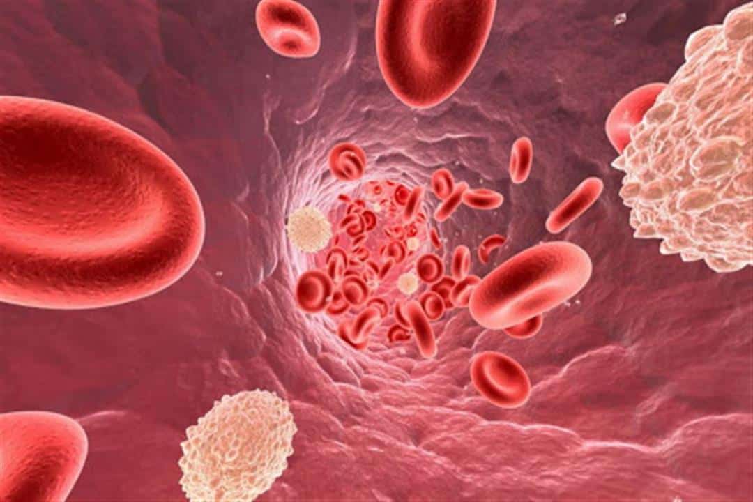 نقص الصفائح الدموية.. أهم أسبابه وطرق علاجه