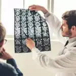أعراض ما قبل جلطة الدماغ وهذه طريقة اكتشافها