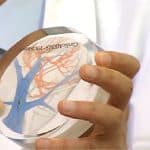 تقنية لاسلكية لمرضى قصور عضلة القلب .. «استشاري» يكشف تفاصيل (فيديو)