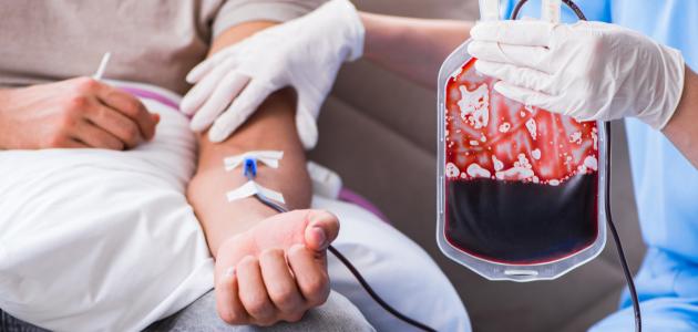 3 أعراض للأنيميا تستدعي التحليل الطبي.. ماهي؟