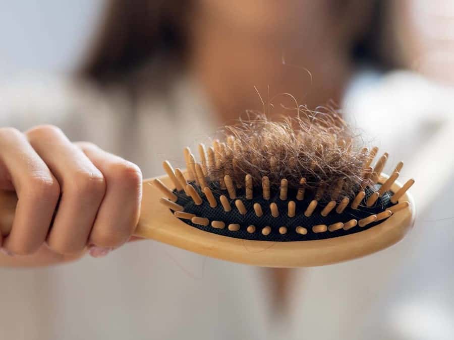 تساقط الشعر