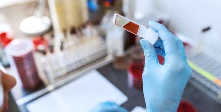 اختبار دم يكشف عن سرطان الرئة مبكرا