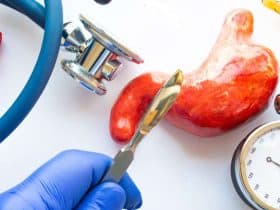 نقص الفيتامينات بعد عملية التكميم يتسبب في مضاعفات خطيرة.. احذر منها