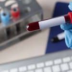 فحوصات قبل الحمل