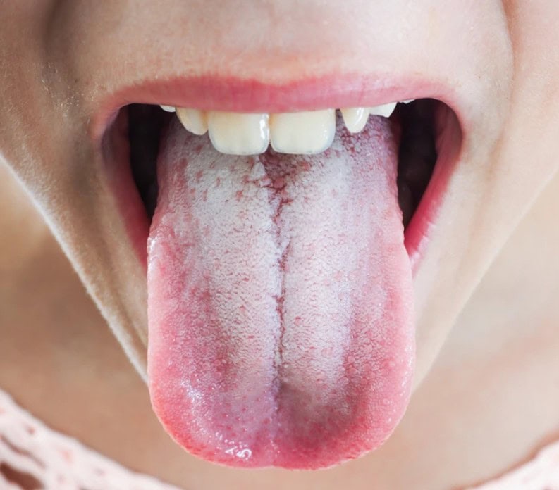 لا تتجاهل هذه العلامات التحذيرية من جسمك
