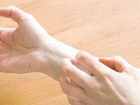 حساسية النيكل