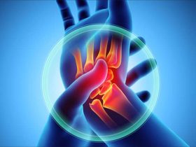 التهاب المفاصل