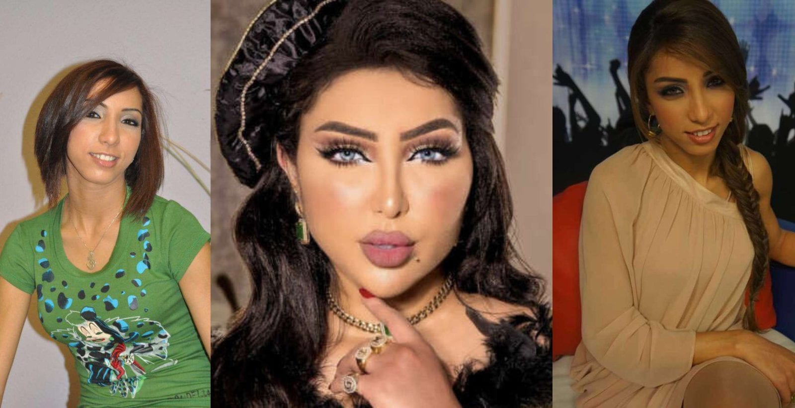 مراحل تطور دنيا بطمة قبل وبعد الشهرة