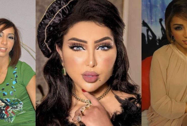مراحل تطور دنيا بطمة قبل وبعد الشهرة