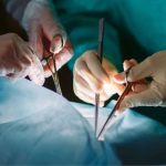 زراعة الأعضاء بين الأنواع - صورة تعبيرية