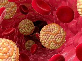 ارتفاع الكولسترول الضار