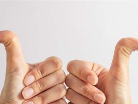 متلازمة إيلرز دانلوس