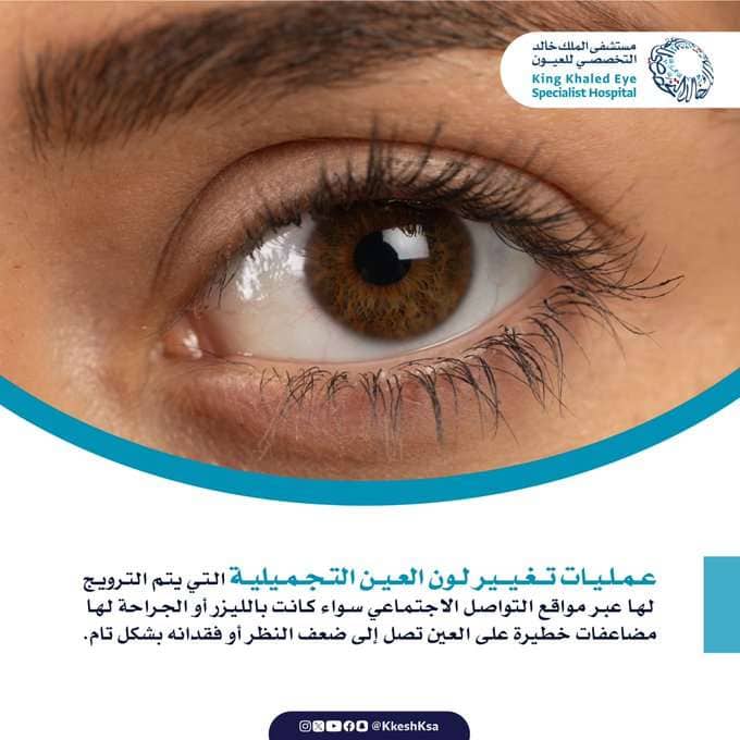 عمليات تغيير لون العين