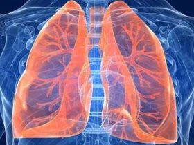 سرطان الرأئة