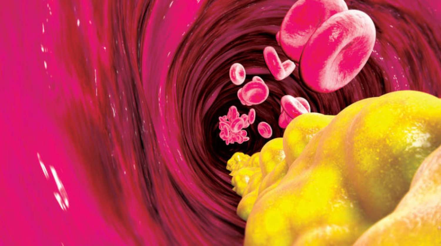 الدهون الثلاثية