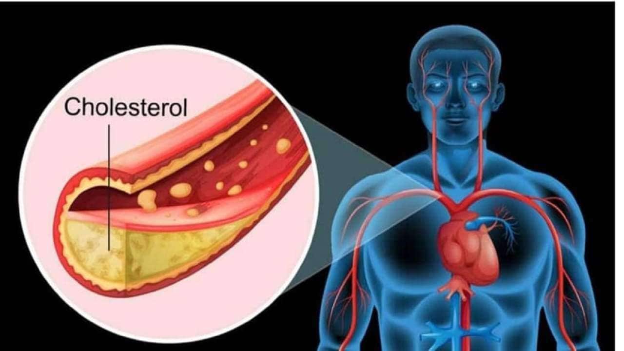 الدهون الثلاثية
