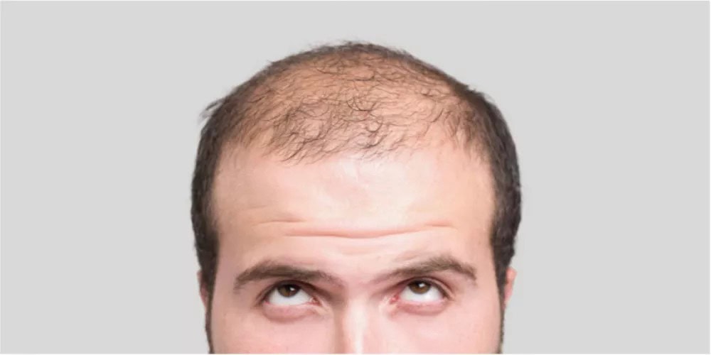 ماذا يخبرنا الشعر عن صحتنا؟