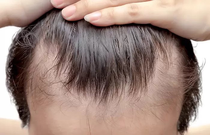 ماذا يخبرنا الشعر عن صحتنا؟