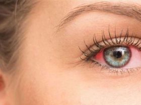 أسباب احمرار العين بعد الاستحمام