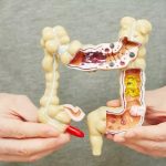 الإمساك مشكلة شائعة وحلول طبيعية.. خطوات