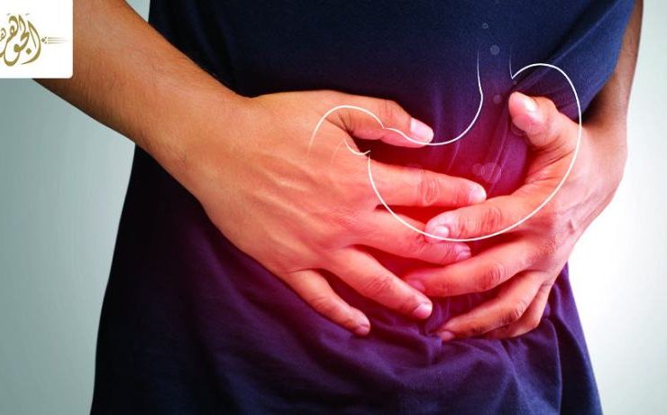 كيفية التخلص من الحموضة في رمضان