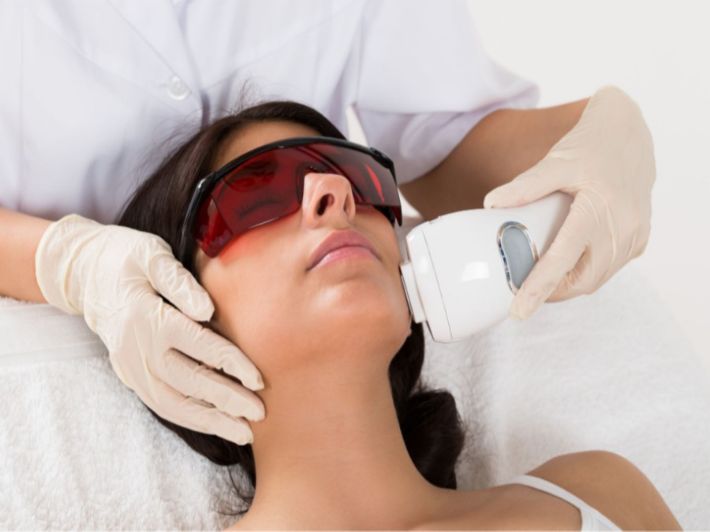 أفضل طرق إزالة شعر الوجة ..خطوات اتبعيها