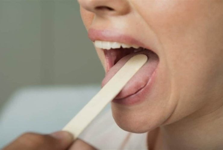 تنميل اللسان