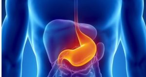 قرحة المعدة