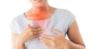 الارتجاع المريئي