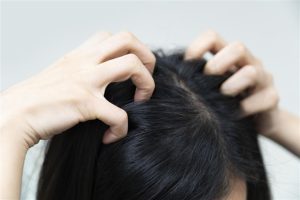 تعرفي على أسباب قشرة الشعر وطرق علاجها