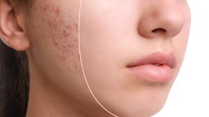 طرق العلاج 