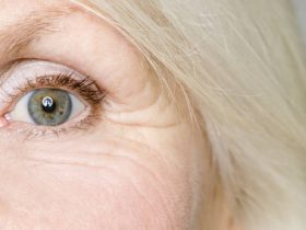 قناع بياض البيض للتخلص من تجاعيد العين.. قناع مفيد