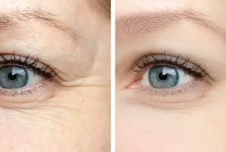 5 طرق لمنع ظهور التجاعيد أثناء النوم..ما هى ؟