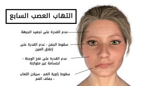 الاعراض