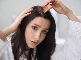 تعرفي على أسباب قشرة الشعر وطرق علاجها