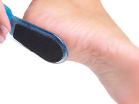 تشققات القدم